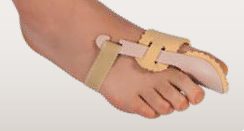 Hallux valgus Nachtschiene