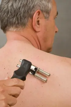 DERMAPUNKTUR-Anti-Schmerz-Roller 200